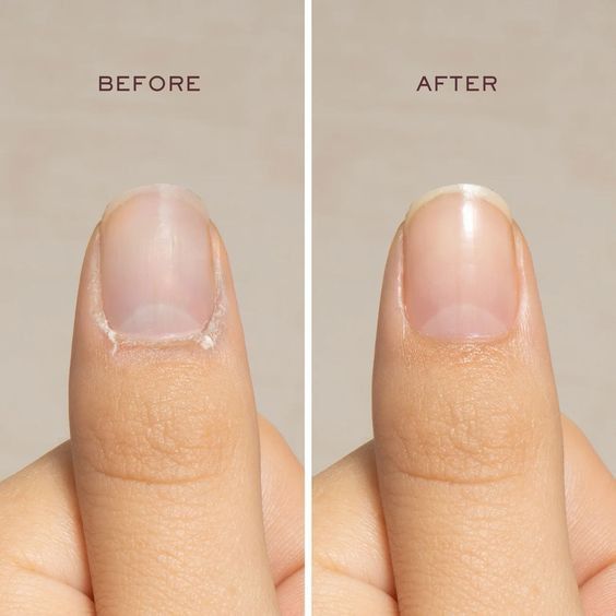 Not moisturizing your nails and cuticles